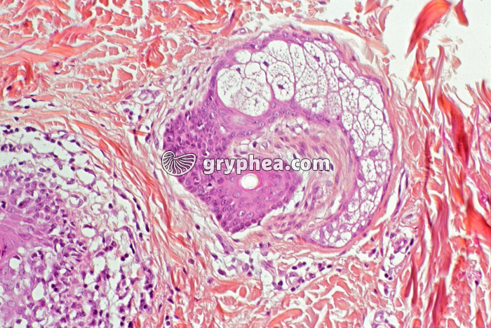 Glande mammaire humaine x70 - gryphea.com